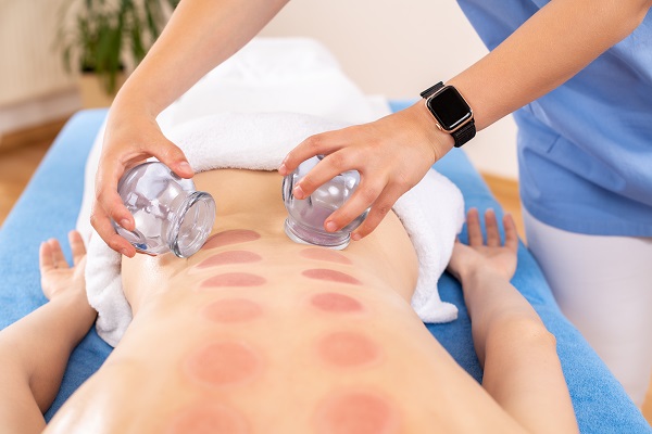 What To Expect When Undergoing Cupping