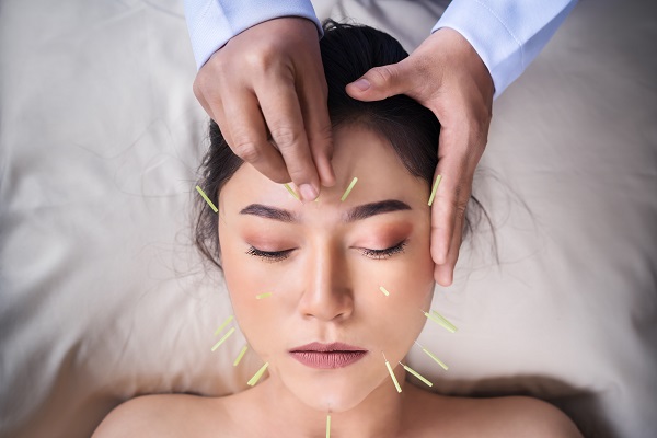 FAQs: Acupuncture For Pain Relief